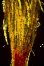 Attēlu rezultāti vaicājumam “Ulota crispa sporophyte”