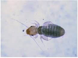 Attēlu rezultāti vaicājumam “Psocoptera”