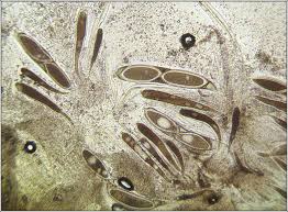 Attēlu rezultāti vaicājumam “Pertusaria pertusa”