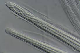 Attēlu rezultāti vaicājumam “Stictis”