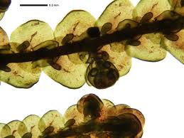 Attēlu rezultāti vaicājumam “Frullania tamarisci macro”