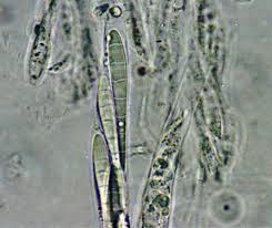 Attēlu rezultāti vaicājumam “Scoliciosporum chlorococcum”