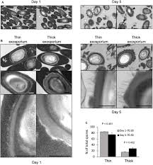 Attēlu rezultāti vaicājumam “Enteridium variabile spores”