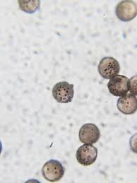 Attēlu rezultāti vaicājumam “Diderma floriforme”