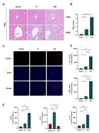 Image result for Calne Alpha 4