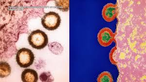 Image result for фотография вируса вич