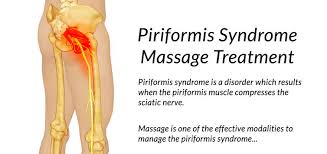 Attēlu rezultāti vaicājumam “Cribraria piriformis”