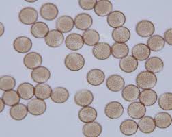 Attēlu rezultāti vaicājumam “Comatricha elegans var. microspora macro”