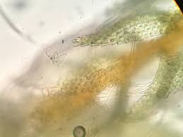 Attēlu rezultāti vaicājumam “Eocronartium muscicola”