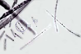 Attēlu rezultāti vaicājumam “Cordyceps stylophora”