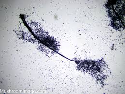 Attēlu rezultāti vaicājumam “Symphytocarpus impexus plasmodium”