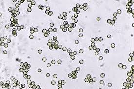 Attēlu rezultāti vaicājumam “Didymium xanthopus spores”