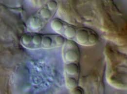 Attēlu rezultāti vaicājumam “Arthonia spadicea”