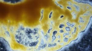 Attēlu rezultāti vaicājumam “Reticularia jurana macro”