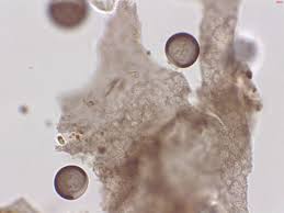 Attēlu rezultāti vaicājumam “Licea minima spores”