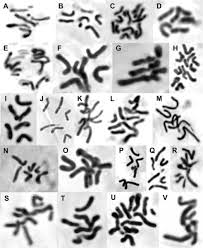 Attēlu rezultāti vaicājumam “Pseudobryum cinclidioides cells”