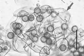 Attēlu rezultāti vaicājumam “Clastoderma debaryanum stalked”