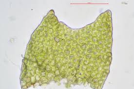 Attēlu rezultāti vaicājumam “Tritomaria exsectiformis cells”