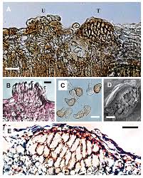 Attēlu rezultāti vaicājumam “Ochropsora ariae spores”