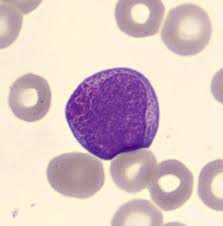 Attēlu rezultāti vaicājumam “Pseudobryum cinclidioides cells”