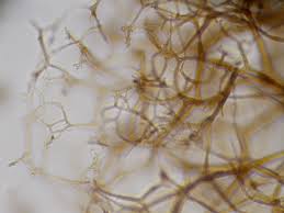 Attēlu rezultāti vaicājumam “Lamproderma pseudomaculatum”