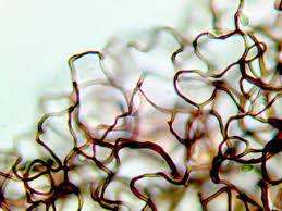 Attēlu rezultāti vaicājumam “Stemonitopsis subcaespitosa”