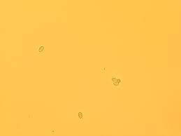 Attēlu rezultāti vaicājumam “Lophocolea minor macro”