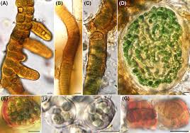 Attēlu rezultāti vaicājumam “Gloeocapsa rupestris”