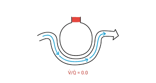 Image result for  v    q