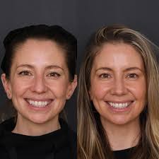 Attēlu rezultāti vaicājumam “Pandemis cinnamomeana female”