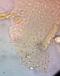 Attēlu rezultāti vaicājumam “Arcyria helvetica stalked”