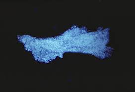 Attēlu rezultāti vaicājumam “Pemphigus borealis”