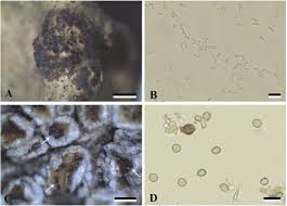 Attēlu rezultāti vaicājumam “Lichenoconium xanthoriae”