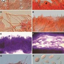 Attēlu rezultāti vaicājumam “Porotheleum fimbriatum”