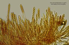 Attēlu rezultāti vaicājumam “Hymenoscyphus calyculus”