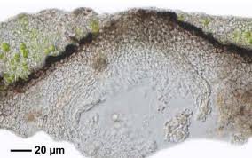 Attēlu rezultāti vaicājumam “Verrucaria hydrela”