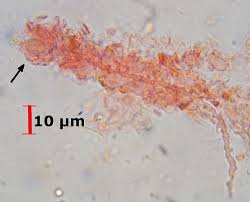 Attēlu rezultāti vaicājumam “Basidiodendron”