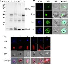 Attēlu rezultāti vaicājumam “Dianema depressum plasmodium”