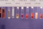 b326-1 clostridium <b>tetani</b>