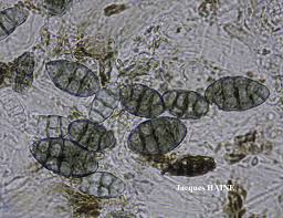 Attēlu rezultāti vaicājumam “Diachea muscorum spores”