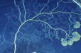 Attēlu rezultāti vaicājumam “Fuligo septica var. candida plasmodium”