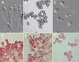 Attēlu rezultāti vaicājumam “Mycosphaerella millegrana”