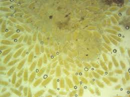 Attēlu rezultāti vaicājumam “Bactridium flavum”