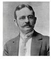 Robert Abbe, 1851 - 1928. New York surgeon who first used lip-switch (Abbe) ... - Robert_Abbe