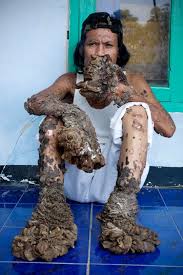 Image result for Lewandowsky-Lutz