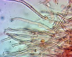 Attēlu rezultāti vaicājumam “Rimbachia neckerae”