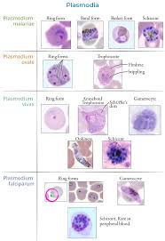 Attēlu rezultāti vaicājumam “Didymium spongiosum plasmodium”