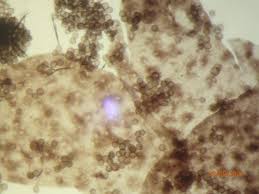 Attēlu rezultāti vaicājumam “Lamproderma puncticulatum”