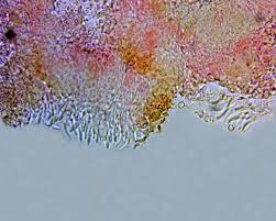 Attēlu rezultāti vaicājumam “Hypocrea pulvinata”