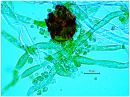 Attēlu rezultāti vaicājumam “Herzogiella seligeri sporophyte”